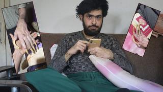 Okul birincisiydi telefona bağımlı hale geldi! 3 yıldır evden çıkmıyor: Duş almıyor, tırnaklarını kesmiyor