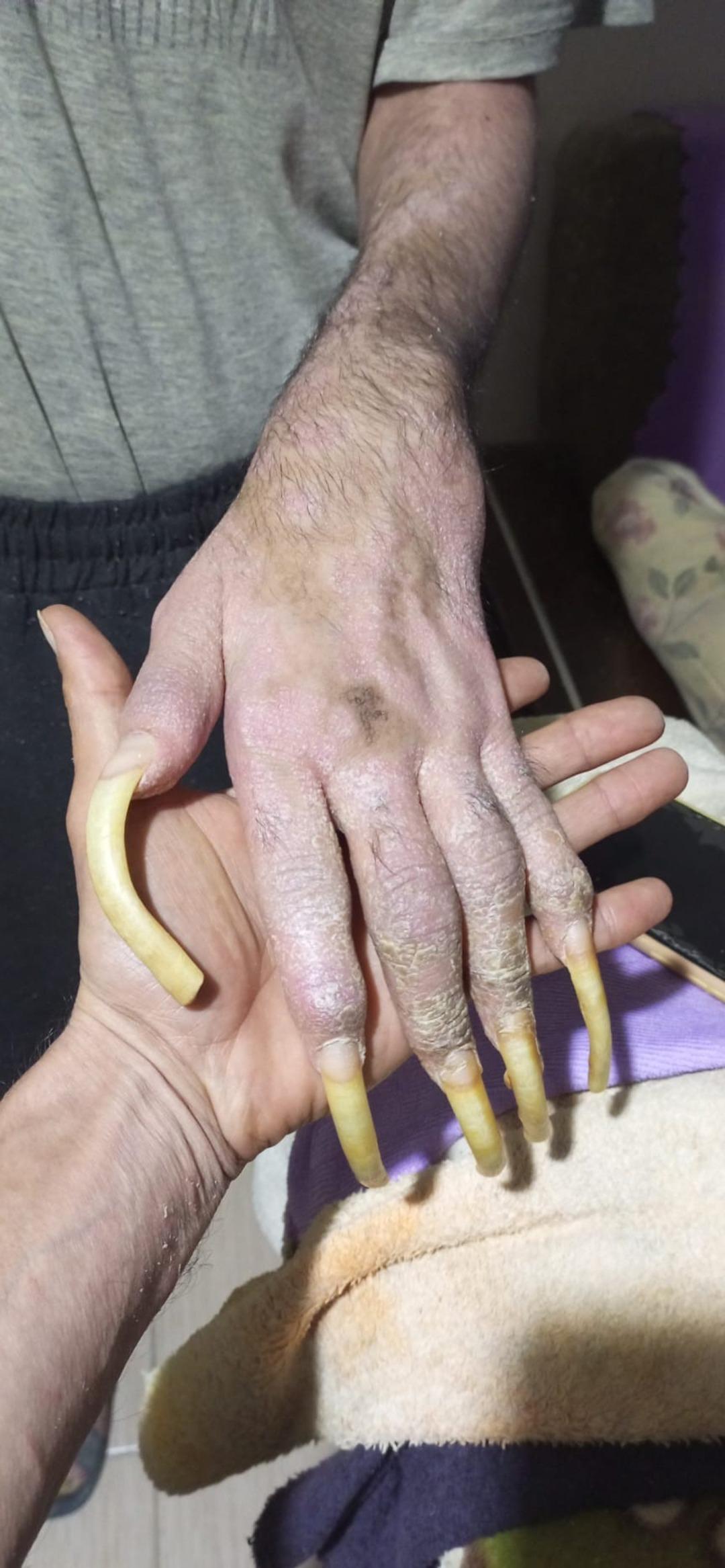 Okul birincisiydi telefona bağımlı hale geldi! 3 yıldır evden çıkmıyor: Duş almıyor, tırnaklarını kesmiyor 3