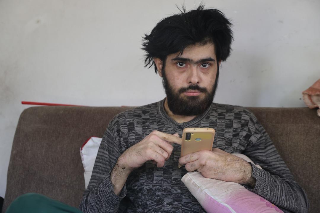 Okul birincisiydi telefona bağımlı hale geldi! 3 yıldır evden çıkmıyor: Duş almıyor, tırnaklarını kesmiyor 6