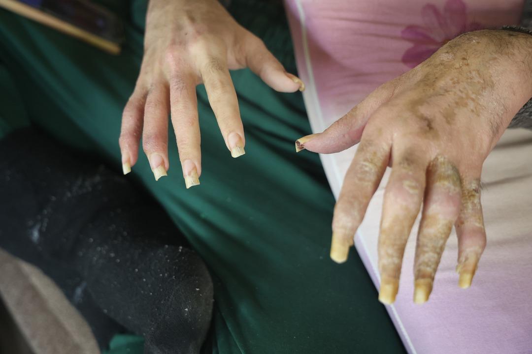 Okul birincisiydi telefona bağımlı hale geldi! 3 yıldır evden çıkmıyor: Duş almıyor, tırnaklarını kesmiyor 8