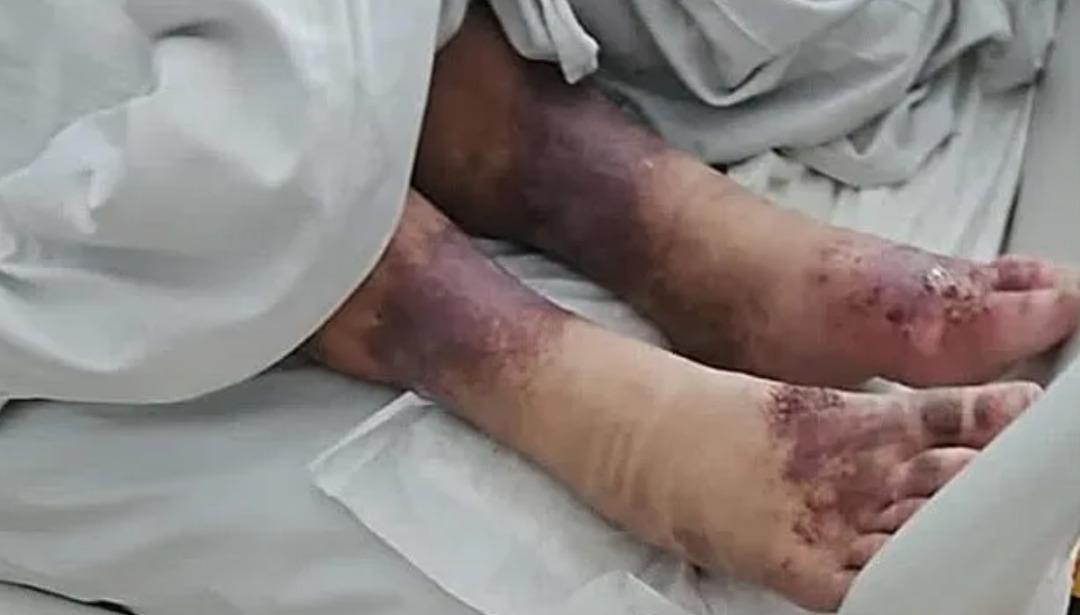 Kızlarını 27 yıl boyunca odaya hapsettiler! Ölümüne günler kala korkunç halde bulundu 2