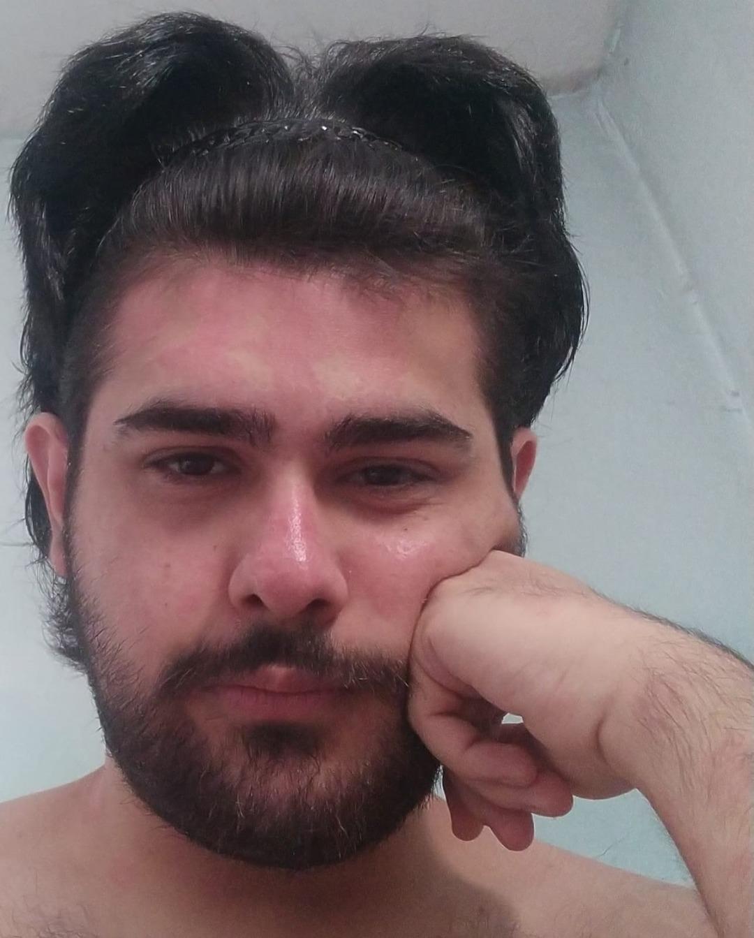 3 yıldır tırnaklarını kesmiyor, duş almıyordu! Eve kapanan gencin eski hali ortaya çıktı 5