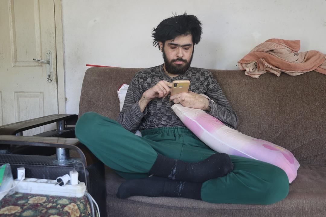 3 yıldır evden çıkmıyordu! İkna edildi, tıraş olup banyo yaptırıldı! İşte yeni hali... 1