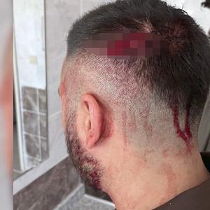 Öğrencilerinin yanında veli tarafından darp edildi! Canını kurtardı görevi bıraktı