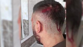 Öğrencilerinin yanında veli tarafından darp edildi! Canını kurtardı görevi bıraktı