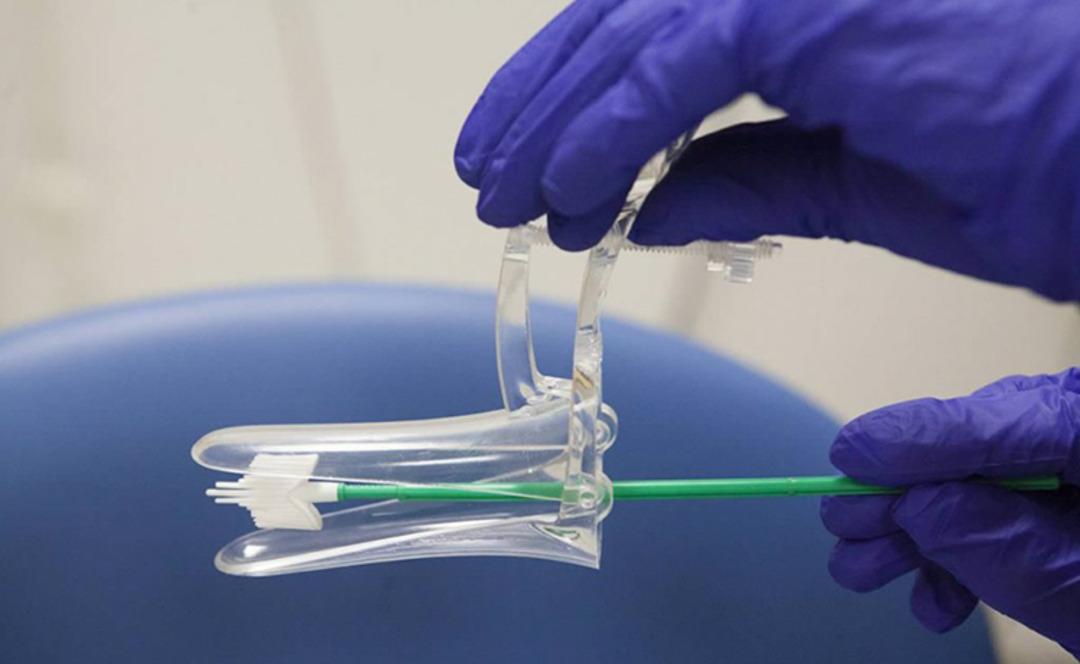 Küçük bir test, büyük bir fark! Rahim ağzı kanserini hafife almayın 1