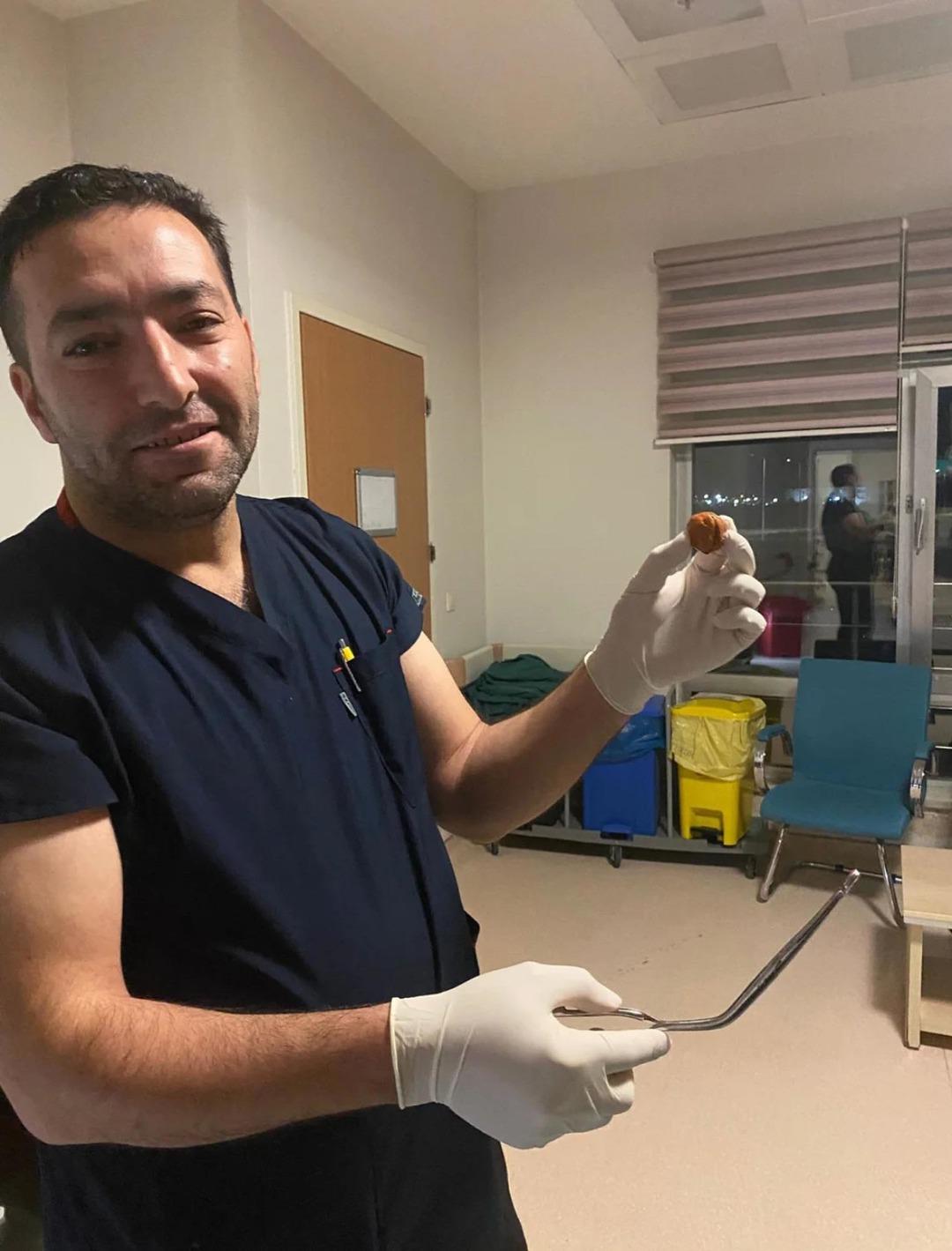 Zihinsel engelli kadının yemek borusuna ceviz kaçtı: Operasyonla çıkarıldı... 1