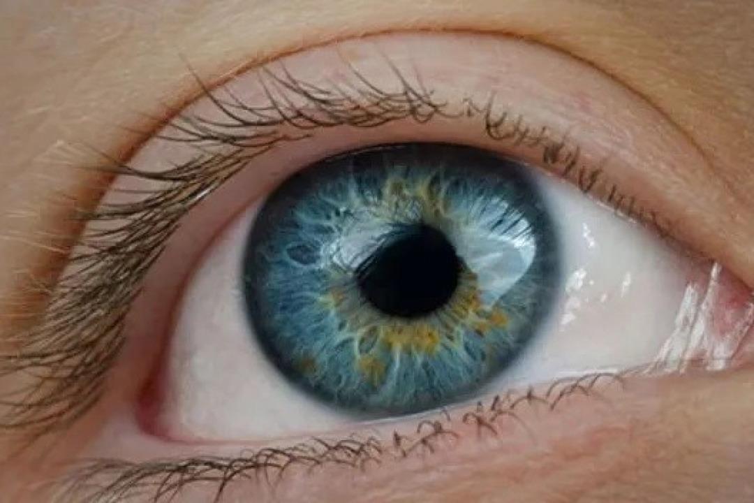 Bilimsel çalışma: Görme kaybı tedavi edilebilir! Uzmanlar: “Şekil ve desen görmeyi ilk kez mümkün kılıyor” 3