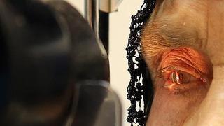 Bilimsel çalışma: Görme kaybı tedavi edilebilir! Uzmanlar: “Şekil ve desen görmeyi ilk kez mümkün kılıyor”