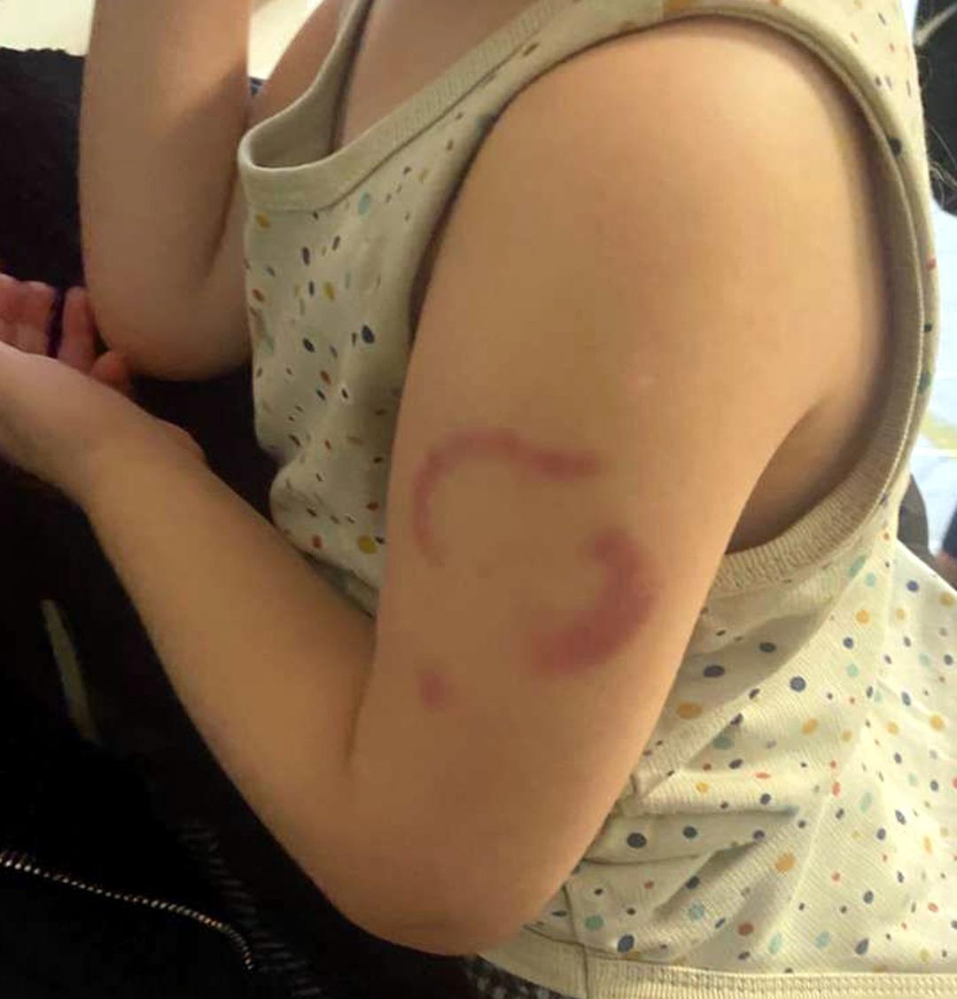 3 yaşındaki öğrencisinin kolunu ısırmıştı! Bakımevinde görev yapan öğretmen tutuklandı 2