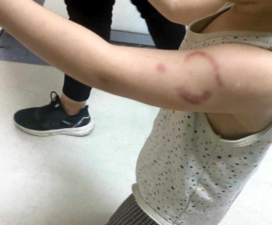 3 yaşındaki öğrencisinin kolunu ısırmıştı! Bakımevinde görev yapan öğretmen tutuklandı 1