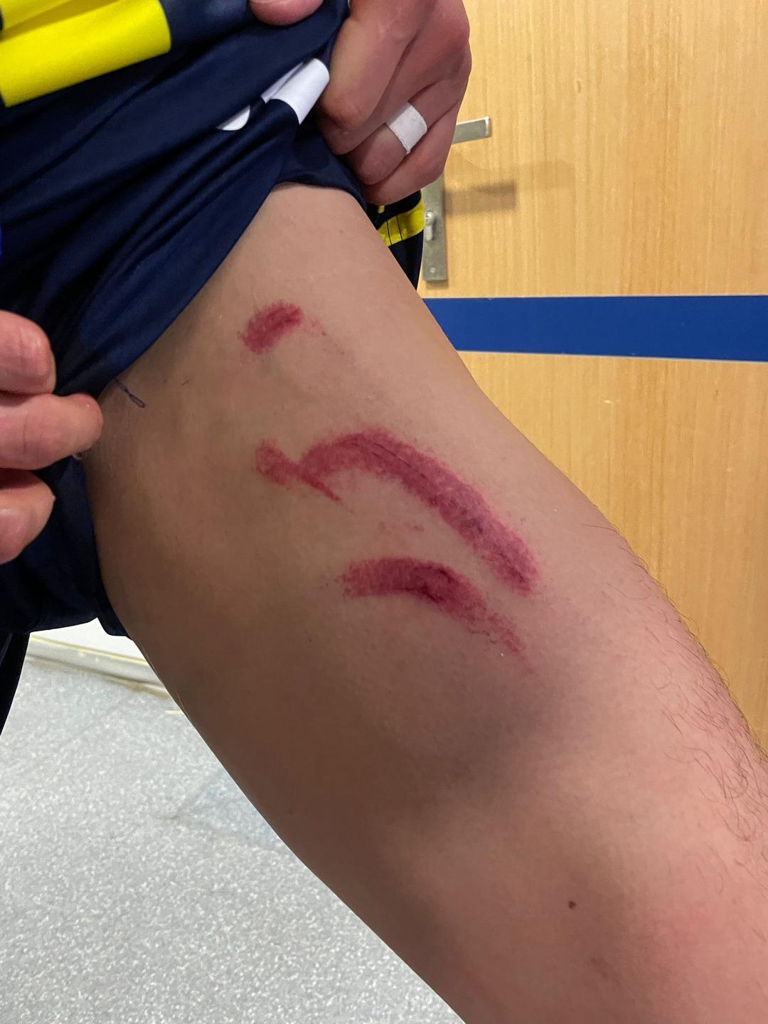 Fenerbahçe-Stuttgart maçının hakemi Jakob Kehlet e tepkiler dinmiyor! Avrupa Ligi ndeki ilk maçıymış. Bence son maçı da olur 3