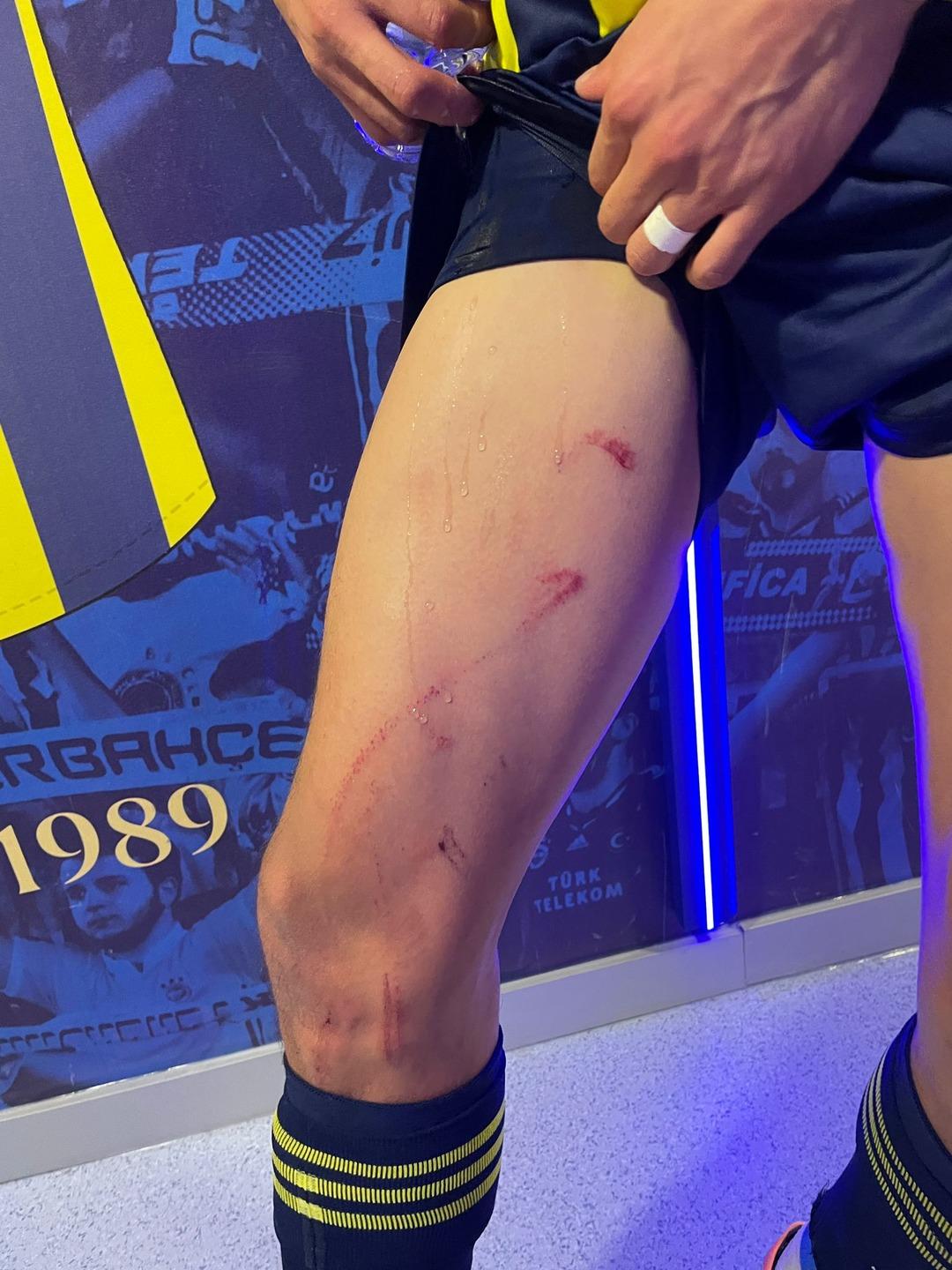 Fenerbahçe-Stuttgart maçının hakemi Jakob Kehlet e tepkiler dinmiyor! Avrupa Ligi ndeki ilk maçıymış. Bence son maçı da olur 6