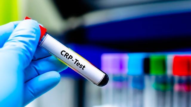 Kan tahlilinde CRP nedir, yüksekliği ne anlama gelir?