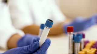 Kan tahlilinde demir değeri nedir, düşükse ne anlama gelir?