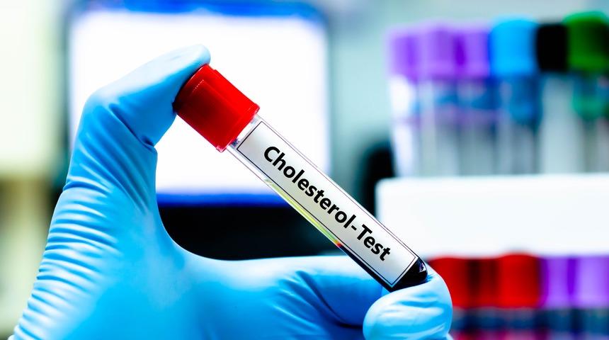 Kolesterol testi nedir, nasıl yapılır?