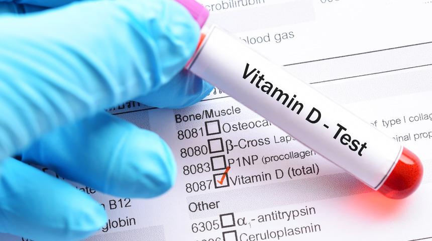 D vitamini testi nedir, neden yapılır?
