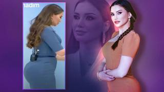 Esra Ezmeci 'kalça estetiği yaptırdı' iddialarına isyan etti! O fotoğrafı savundu sosyal medyada yorum yağdı