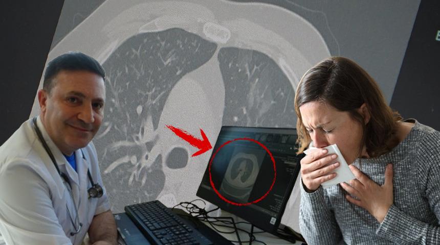 Son haftalarda ciddi artış var! Profesör açıkladı: "3’lü salgın ülkemizde, dikkat olun"