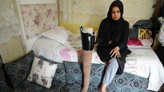 'Asrın felaketi' büyük depremde bacağını kaybetti: Eşi terk etti! Çocuklarımı özlüyorum