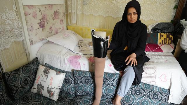 'Asrın felaketi' büyük depremde bacağını kaybetti: Eşi terk etti! Çocuklarımı özlüyorum