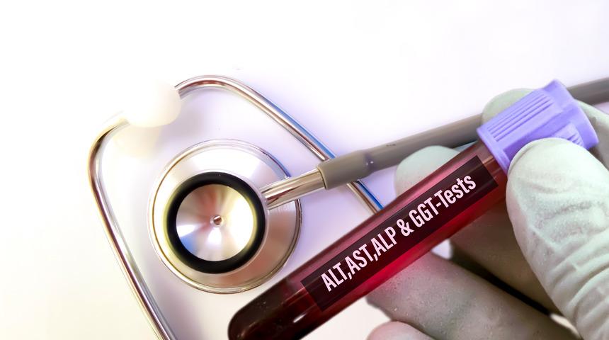 Karaciğer enzim testi nedir, neyi gösterir?