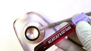 Karaciğer enzim testi nedir, neyi gösterir?