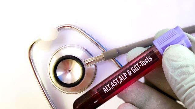 Karaciğer enzim testi nedir, neyi gösterir?