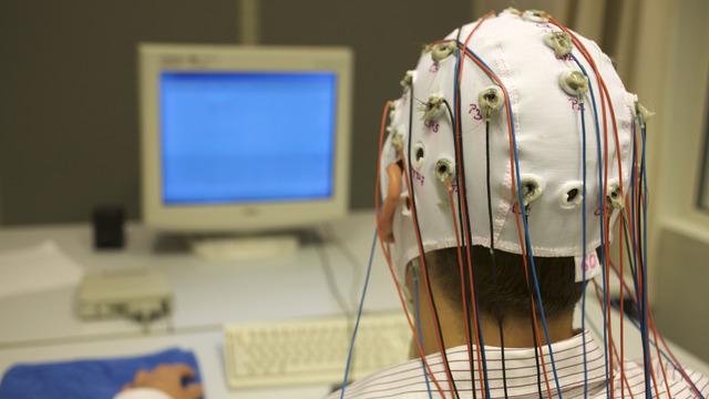 EEG testi nedir, hangi hastalıkları teşhis eder?