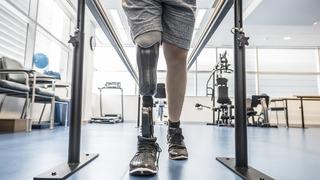 Protez nedir, hangi durumlarda kullanılır?