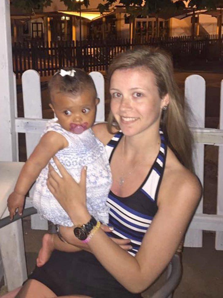 Mide krampıyla hastaneye gitti, doktorlar bile şoke oldu G4