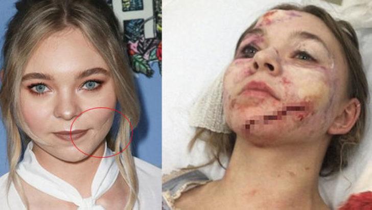 Genç oyuncu hayatının şokunu yaşadı! Sette korkunç kaza G2