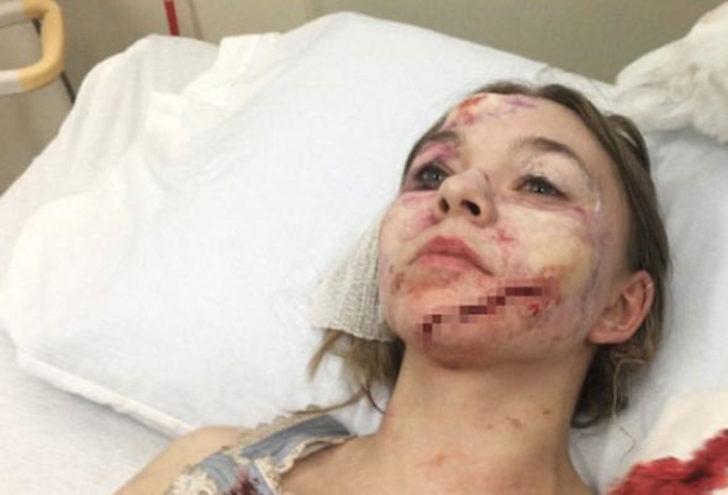 Genç oyuncu hayatının şokunu yaşadı! Sette korkunç kaza G3