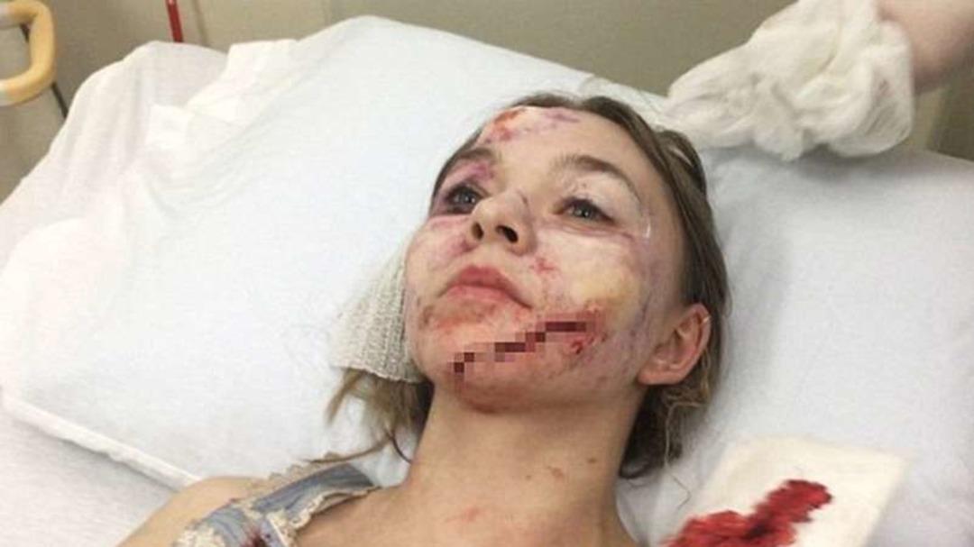 Gen&ccedil; oyuncu hayatının şokunu yaşadı! Sette korkun&ccedil; kaza