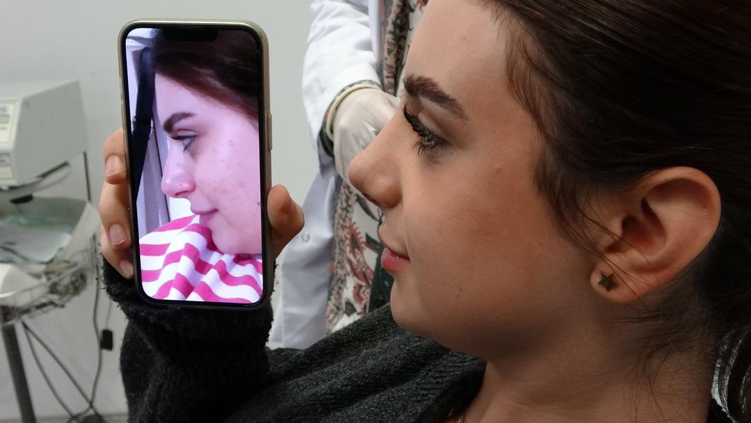 Devlet hastanesinde akıllı estetik dönemi: Yapay zeka destekli estetik cerrahi dönemi başladı 2