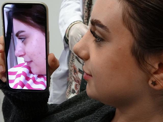 Devlet hastanesinde akıllı estetik dönemi: Yapay zeka destekli estetik cerrahi dönemi başladı