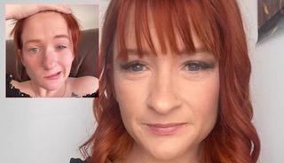 Doğumdan sonra hayatı kabusa döndü: Çay içti, yüzü felç oldu!