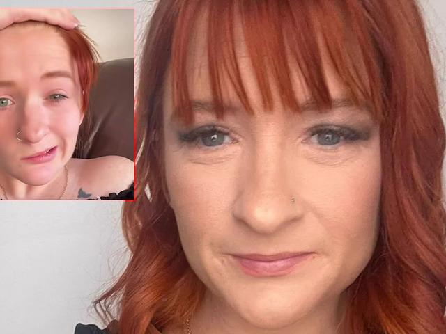 Doğumdan sonra hayatı kabusa döndü: Çay içti, yüzü felç oldu!