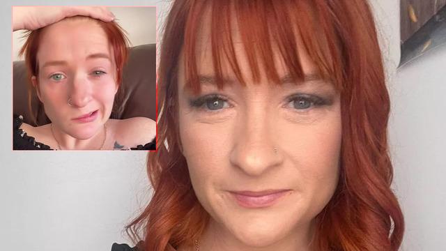 Doğumdan sonra hayatı kabusa döndü: Çay içti, yüzü felç oldu!