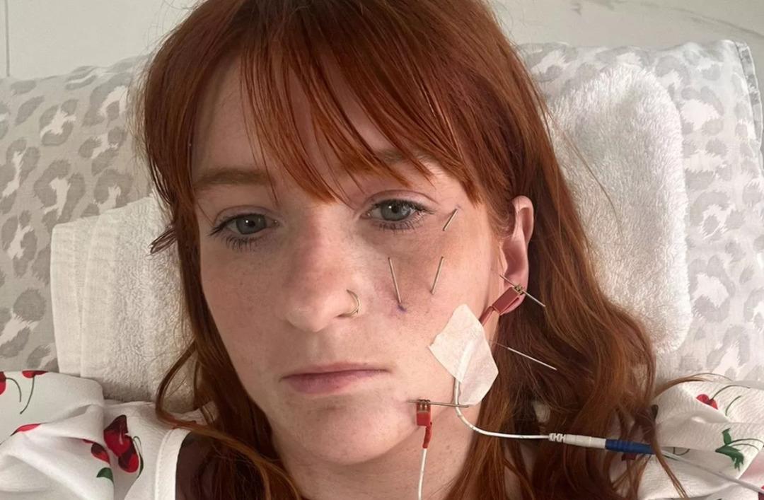 Doğumdan sonra hayatı kabusa döndü: Çay içti, yüzü felç oldu! 2