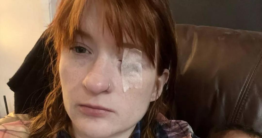 Doğumdan sonra hayatı kabusa döndü: Çay içti, yüzü felç oldu! 1