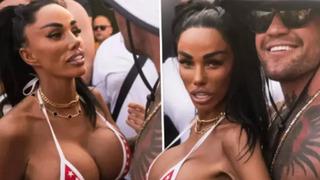 Türkiye'de bir dizi estetik yaptırmıştı! Hastanelik oldu, görenler şaştı kaldı