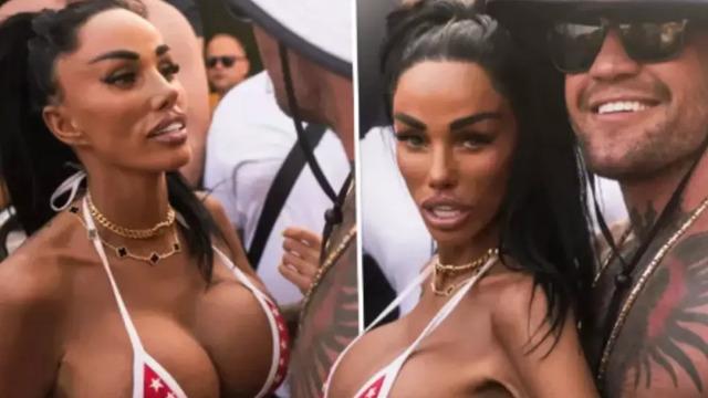 Türkiye'de bir dizi estetik yaptırmıştı! Hastanelik oldu, görenler şaştı kaldı