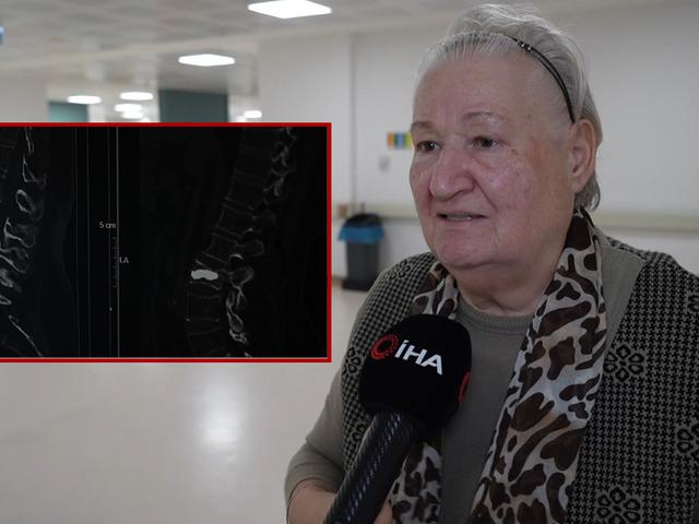 Fıtık sandı: Omurgasında kırık çıktı! 