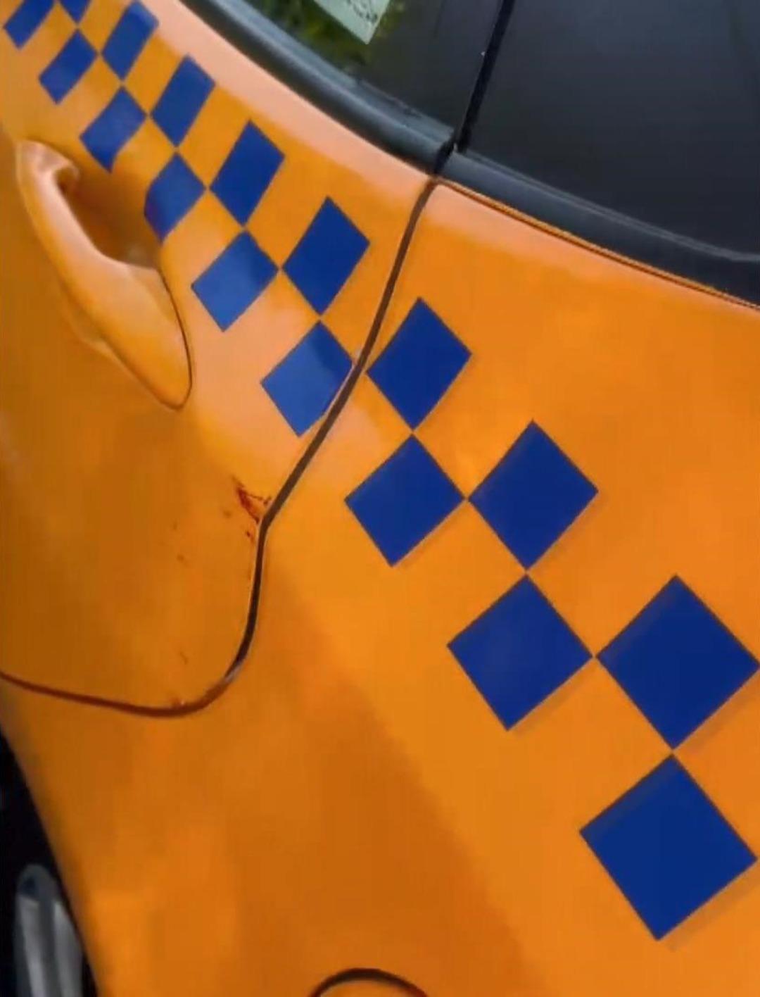 İngiliz boksör taksicinin hayatını kabusa çevirdi! "Yüzüm hala hissiz, uzuv kaybı yaşadım, geceleri bağırarak uyanıyorum..." 1