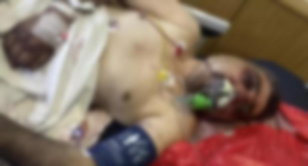 İngiliz boksör taksicinin hayatını kabusa çevirdi! "Yüzüm hala hissiz, uzuv kaybı yaşadım, geceleri bağırarak uyanıyorum..." 4