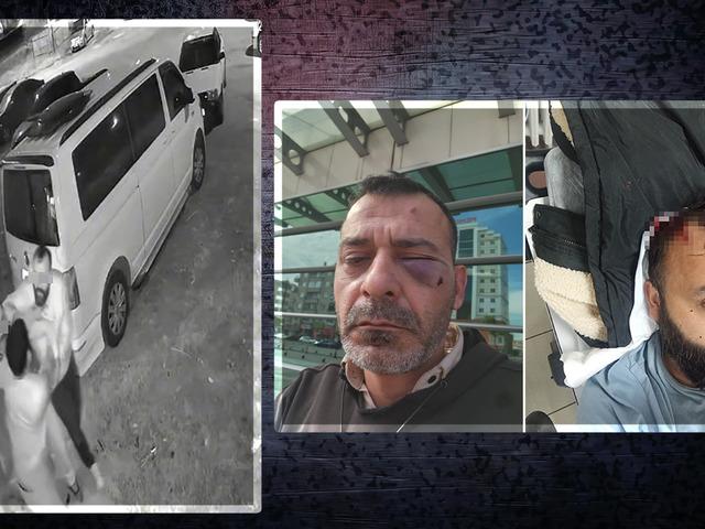 Sosyal medya fenomenini öldüresiye darbettiler! 3.7 milyon takipçisi var: "Kaburgası kırık, iç kanaması var..."