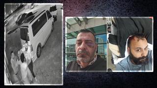 Sosyal medya fenomenini öldüresiye darbettiler! 3.7 milyon takipçisi var: Kaburgası kırık, iç kanaması var...