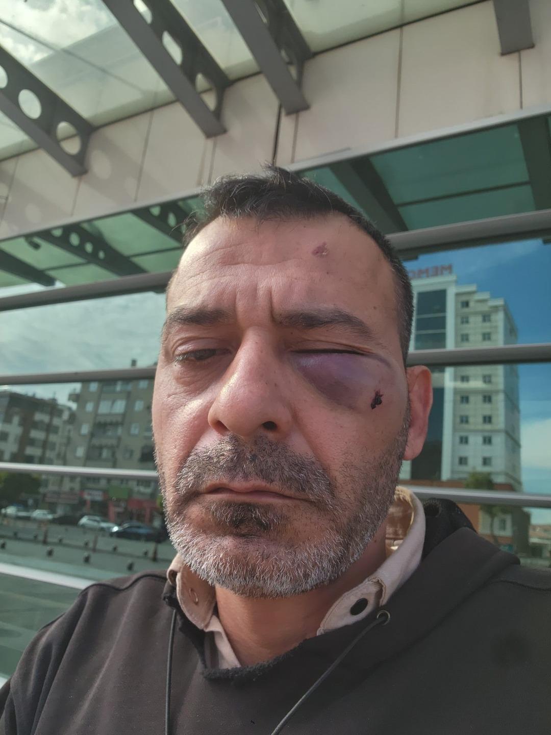 Sosyal medya fenomenini öldüresiye darbettiler! 3.7 milyon takipçisi var: "Kaburgası kırık, iç kanaması var..." 3