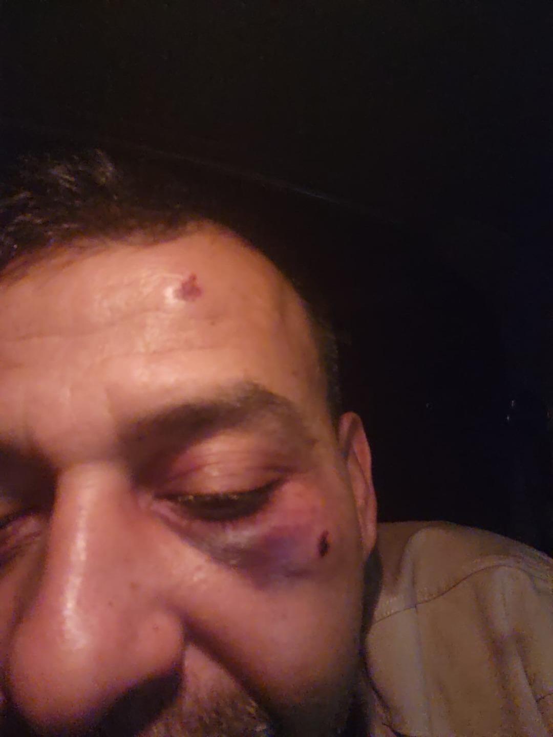 Sosyal medya fenomenini öldüresiye darbettiler! 3.7 milyon takipçisi var: "Kaburgası kırık, iç kanaması var..." 4